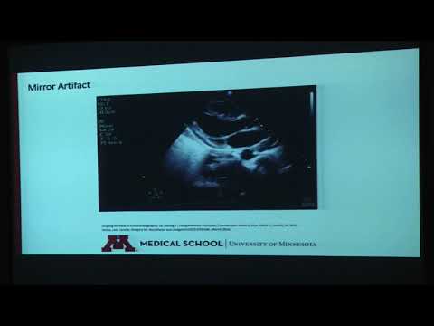 20180824_21_ Artifacts_and_pitfalls_Roy_Kiberenge_Dr