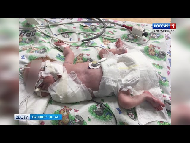 Врачи ампутировали руку новорожденному мальчику. Мама малыша винит медиков в халатности: женщина 12 лет мечтала о ребенке