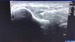 Video 3