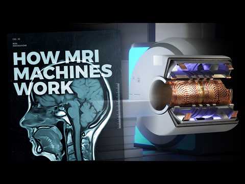 The Marvels of MRI Technology: How it Works and Its Impact on Medicine