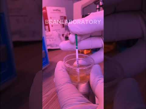 URINE PREGNANCY TEST// simple procedure