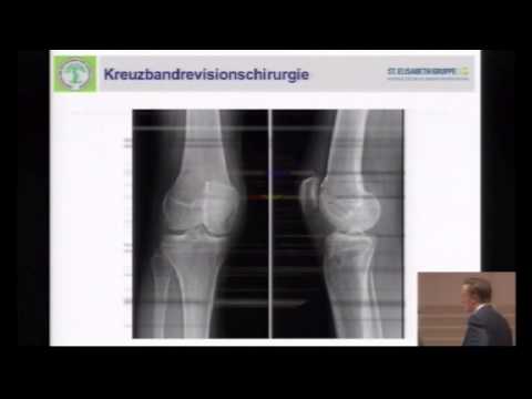Akute Pharyngitis Schmerzen im Nacken Rückenschmerzen während der Schwangerschaft 9 Monate