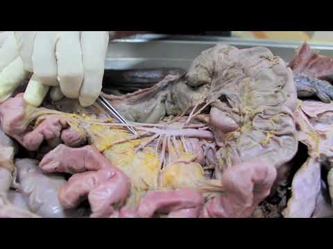 cum pierzi omentum grăsime pierderea în greutate pentru sindromul metabolic