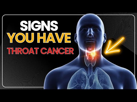 10 Signs You Have Throat Cancer