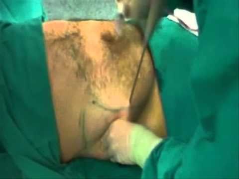 Acquistare vietato patogeno femminile Menta provoca limpotenza