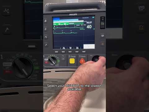 Transcutaneous Pacing (TCP) using a Philips Heartstart Intrepid
