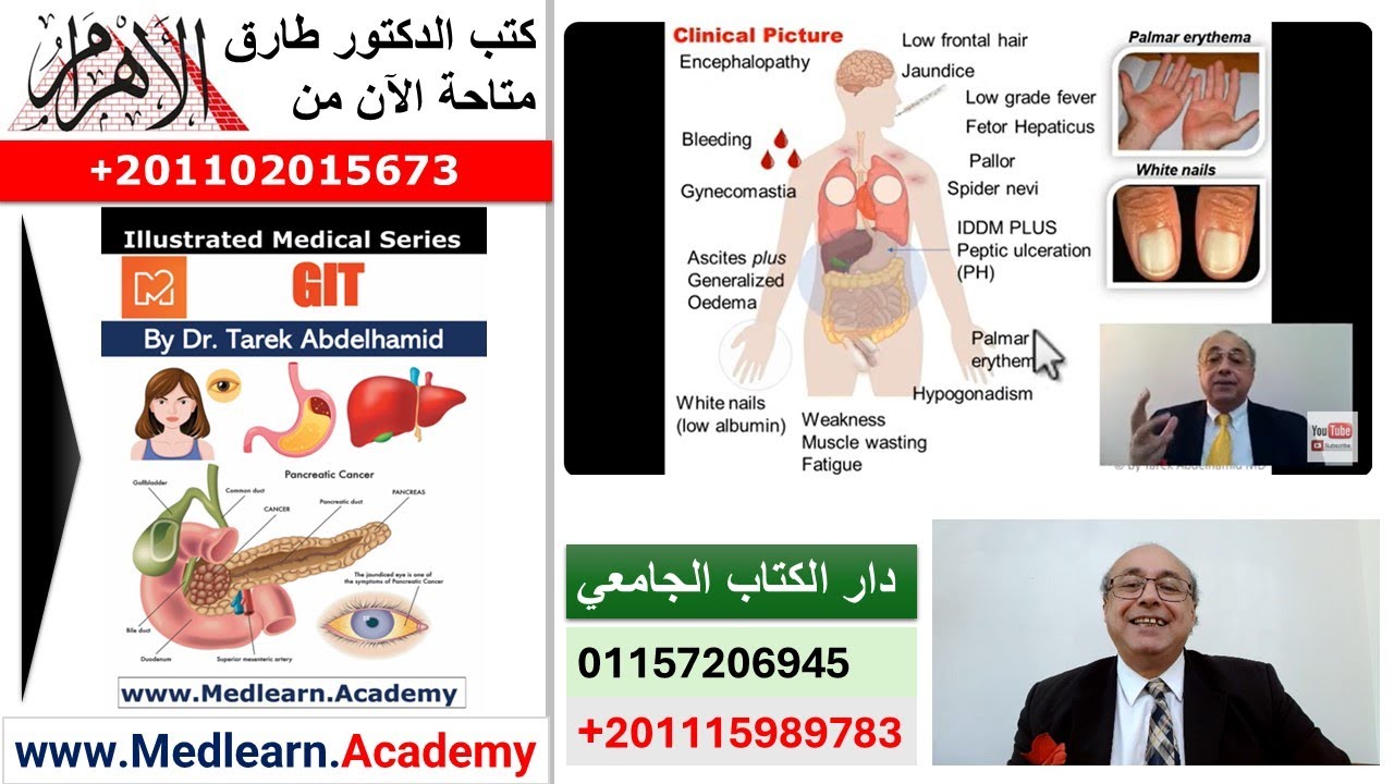 Manifestations of Liver Cell Failure  #internal_medicine #cme  #ecg #محاضرات_باطنة #medical
