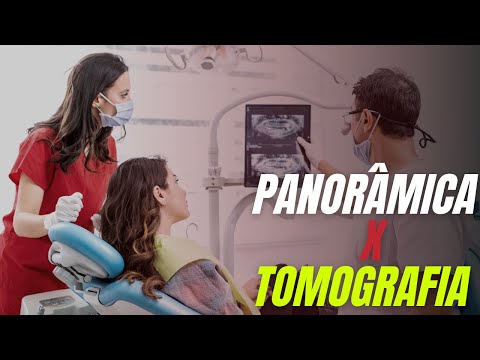 RADIOGRAFIA PANORÂMICA E TOMOGRAFIA DENTÁRIA E SUAS DIFERENÇAS