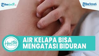 Khasiat Minum Air Kelapa Bisa Obati Biduran, Inilah Cara Mudah Atasi Rasa Gatal Kemerahan di Kulit