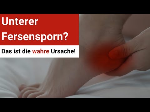 Unterer Fersensporn (Plantarfasziitis) ⚡ Erklärung und die wahre Ursache! ➡️