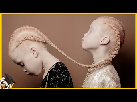 10 Barn Som Bara Föds En Gång På Tusen År