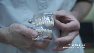 Férula de descarga en la Clínica Somosaguas