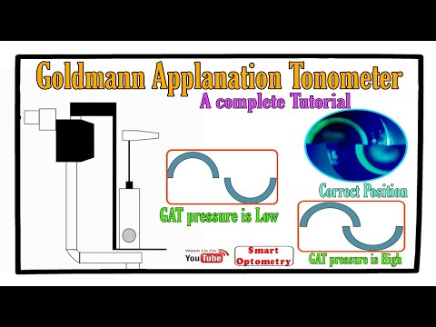 Goldmann Applanation Tonometer - Complete Tutorial.
