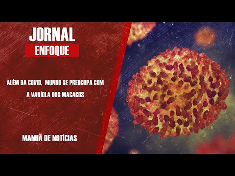 ALÉM DA COVID,  MUNDO SE PREOCUPA COM A VARÍOLA DOS MACACOS