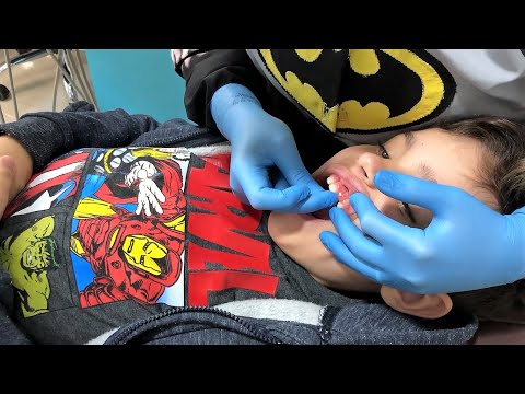 BENÍCIO foi ao DENTISTA e ganhou uma SURPRESA - Família Amigo dos brinquedos