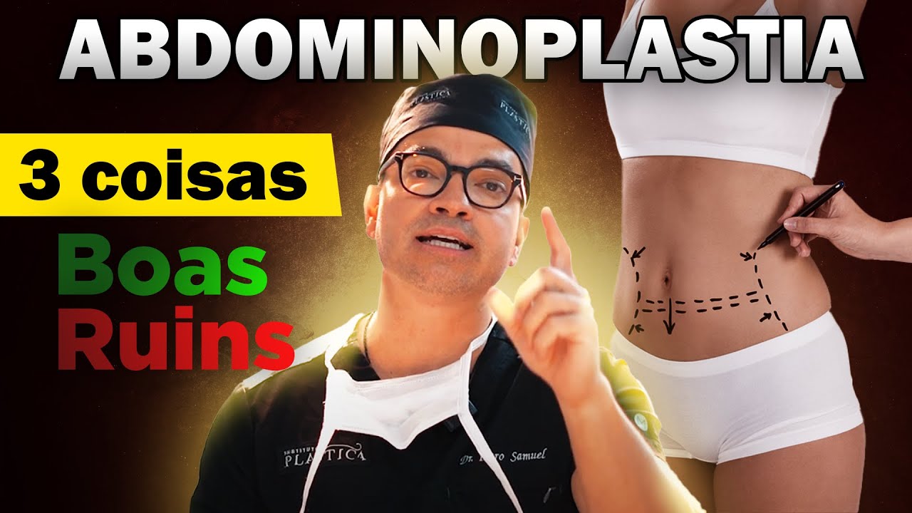 3 COISAS BOAS E 3 COISAS RUINS DA ABDOMINOPLASTIA  - CIRURGIA PLÁSTICA