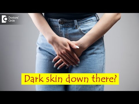Dark skin of private parts in women. Causes & How to lighten it? - Dr. Regina Joseph|Doctors' Circle