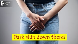 Dark skin of private parts in women. Causes & How to lighten it? - Dr. Regina Joseph|Doctors