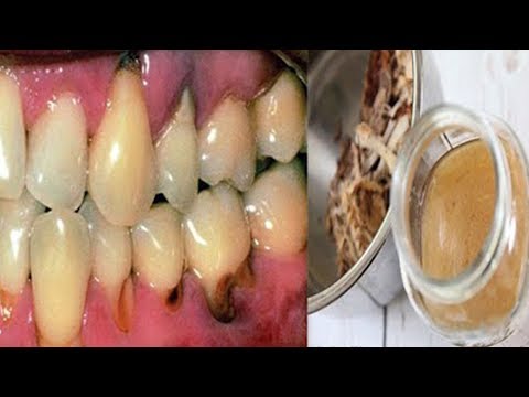 Das Analogon flüssig eksoderila für die Nägel Die Entzündung der Finger der Hände neben dem Nagel die Behandlung