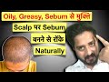 Natural Remedies For Oily Greasy And Excess Sebum On Scalp And Hair