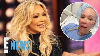 Jelly Roll’s Wife Bunnie Xo Shares Raw Look at Facelift Recovery | E! News