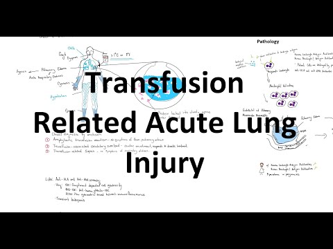 Transfusion Related Acute Lung Injury - TRALI