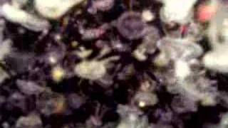 Blah Blah Blah Blah I'm a Jelly Fish