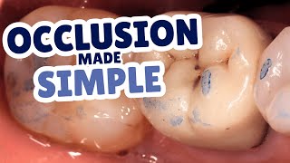 Plant it Low, Let it Grow? Occlusion, CR and all things Confusing for Students - PS010
