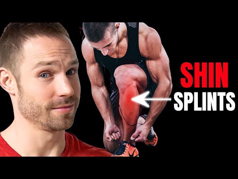 How to Fix Shin Splints in 3 Simple Steps (Doctor-Approved)