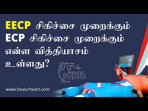 EECP சிகிச்சை முறைக்கும் ECP சிகிச்சை முறைக்கும் என்ன வித்தியாசம் உள்ளது?