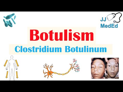 botulism și viziune există lentile colorate pentru îmbunătățirea vederii