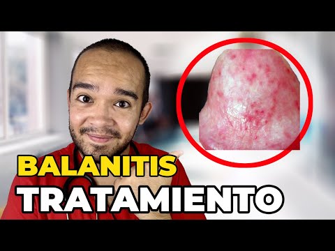 HOW TO CURE BALANITIS
