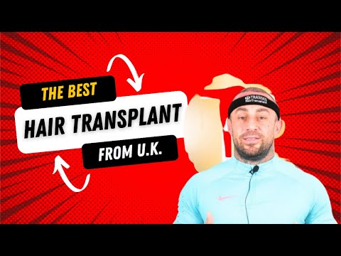 From #uk #hairtransplant #transes #transeshairtransplant