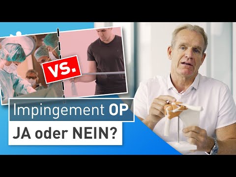 Schulter Impingement - OP notwendig? Entscheidungshilfe von Dr. Stefan Preis