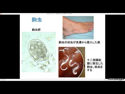 【山梨大学】YAMANASHI-WAY（継続育成型高校生プログラム）講義動画その２「私たちが知らない、寄生虫の世界」