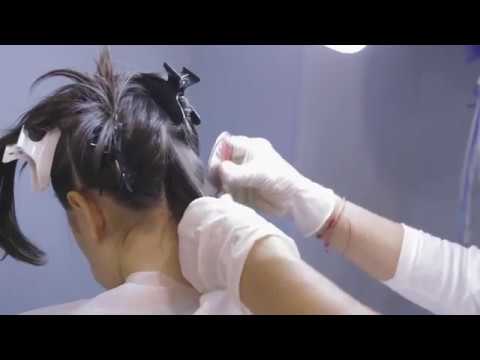 Gap mediale del menisco del ginocchio grado 3 trattamento Osteocondrosi prezzo trattamento laser