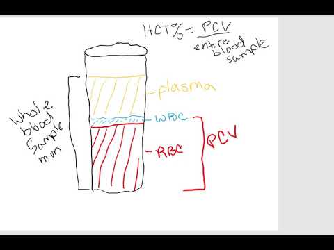 Physioex11 Discussion