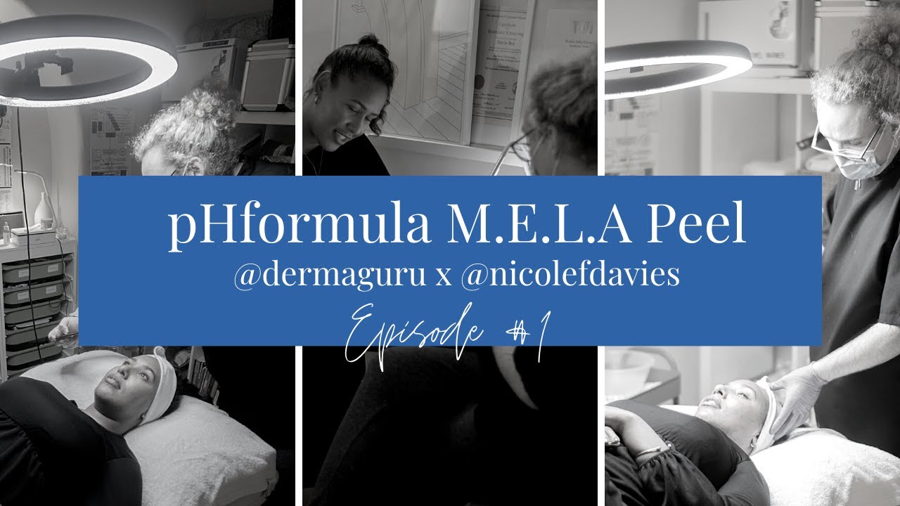 pHformula M.E.L.A Peel | Treatment For Dark Spots & Hyperpigmentation | @nicolefdavies x @dermaguru