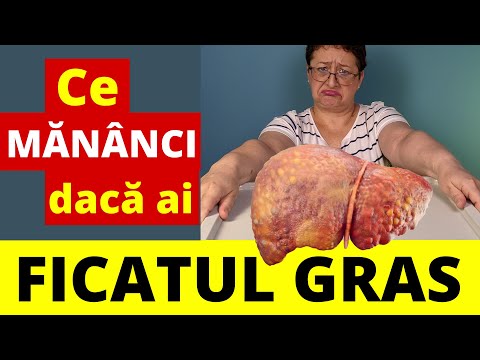Cât de GRAS este Ficatul Tău? - 5 Remedii Alimentare pentru Steatoza Hepatică