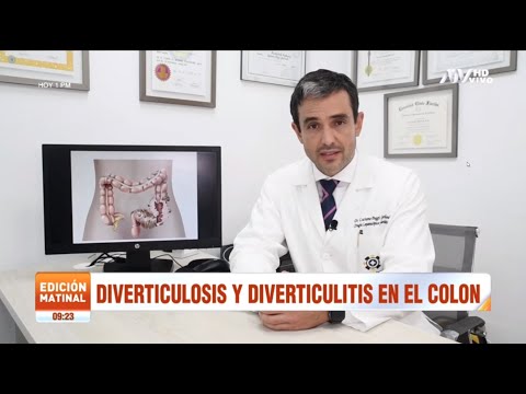 Diverticulosis y diverticulitis en el colon