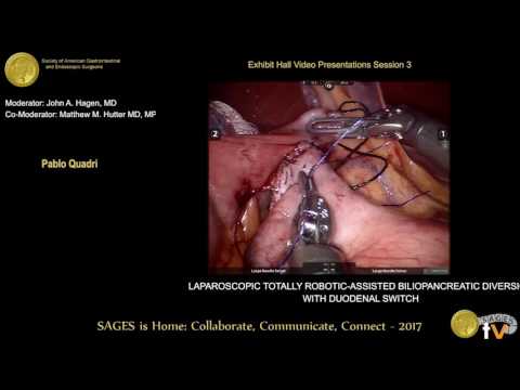 Latest Advancements in BPD/DS Surgery