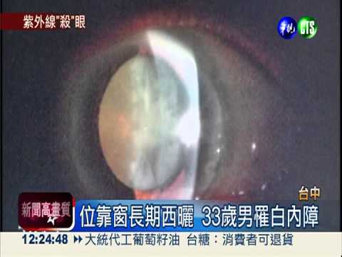 長時間日照 33歲工程師罹白內障