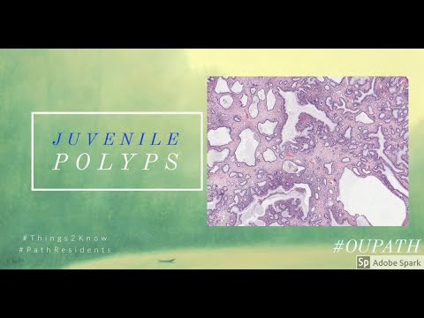 Juvenile Polyps of GI tract