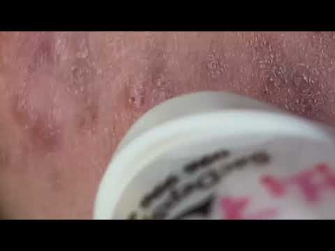 Relax Every Day With Sac Dep Spa #0384 3