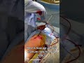 Here is how we remove titanium rods from the femur..
