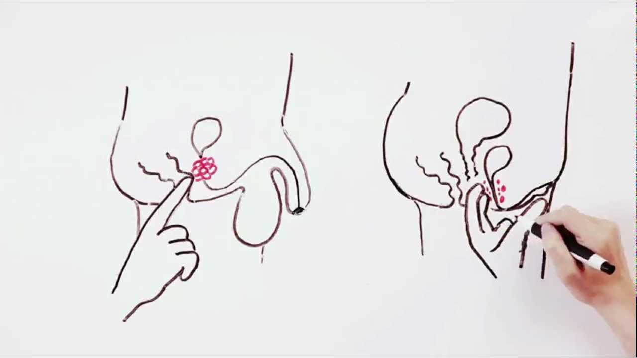 RFSU:s film om att klitoris är lika stor som en penis