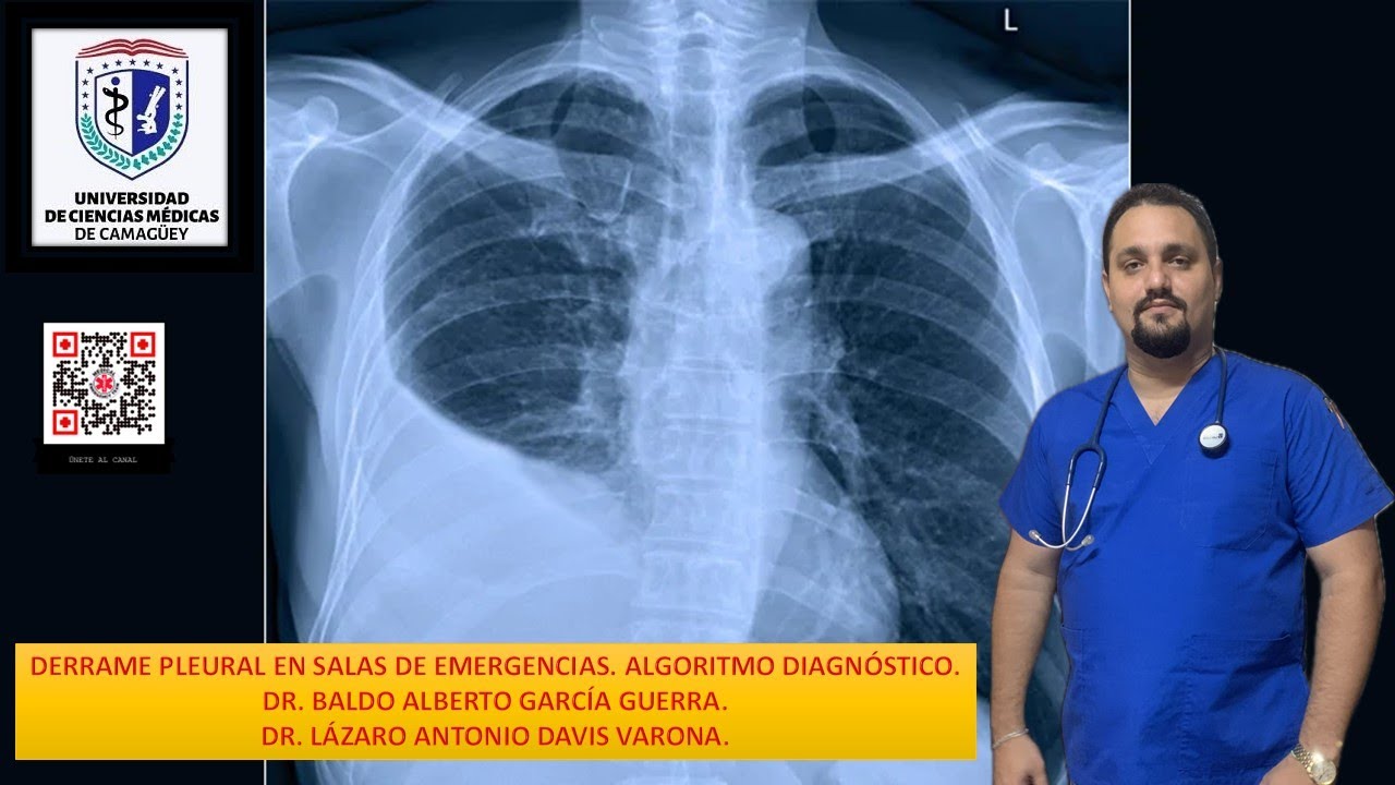 DERRAME PLEURAL. ALGORITMO EN SALAS DE URGENCIAS