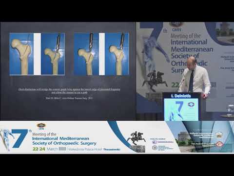 Delniotis I - Intertrochanteric fractures: Why does surgery fail?