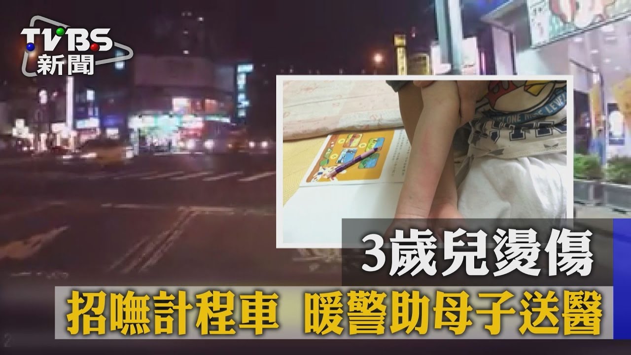 3歲兒燙傷招嘸計程車 暖警助母子送醫
