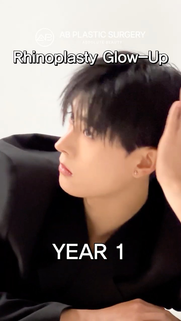 Just a Nose Job Made Him Handsome